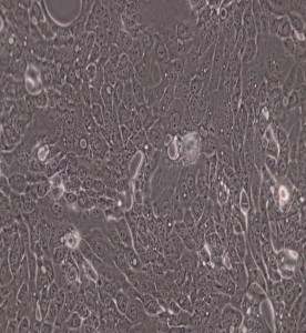 CFPAC-1人胰腺癌細(xì)胞主圖