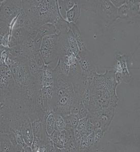 HCC1937人乳腺癌細胞主圖