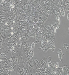 HCT-15人結(jié)直腸腺癌細(xì)胞主圖