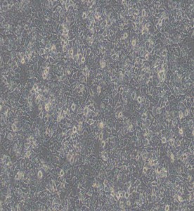 HuH-7人肝癌細(xì)胞主圖