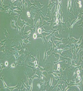 KYSE-410人食管鱗癌細胞主圖