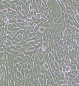 R-1610倉(cāng)鼠肺細(xì)胞主圖