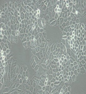 NCI-H460[H460]人大細(xì)胞肺癌細(xì)胞主圖