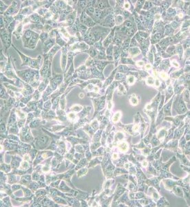 95-D[PLA-801D]人高轉(zhuǎn)移肺癌細胞主圖