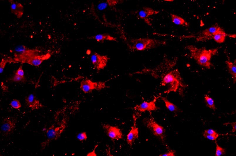 大鼠肺微血管內(nèi)皮細胞主圖