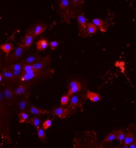 大鼠肝實(shí)質(zhì)細(xì)胞主圖