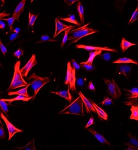 大鼠結(jié)腸平滑肌細胞主圖