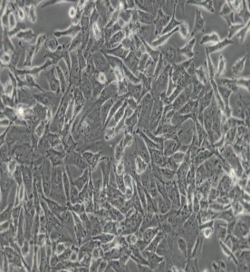 SK-HEP-1人肝癌細胞主圖