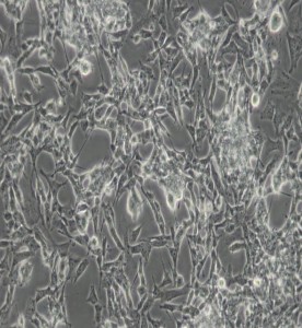 SK-N-BE(2)-C人神經(jīng)母細胞瘤細胞主圖