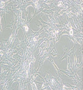 Hey人卵巢癌細(xì)胞主圖