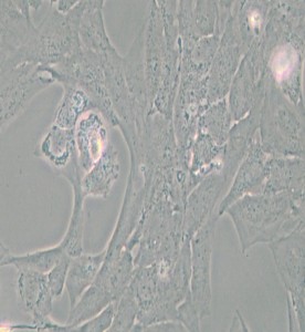 NCI-H196人小細(xì)胞肺癌細(xì)胞主圖