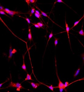 大鼠脊髓神經(jīng)元細(xì)胞主圖