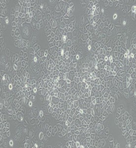 SW-13人腎上腺皮質(zhì)小細(xì)胞癌細(xì)胞(L15)主圖