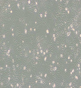 SW872人脂肪肉瘤細(xì)胞(DMEM)主圖