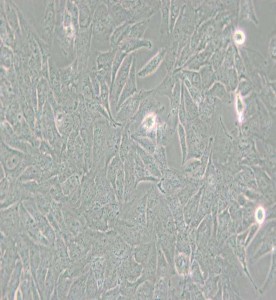 TCCSUP人膀胱癌細(xì)胞主圖