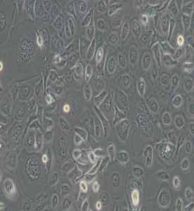 TE-1人食管癌細胞主圖