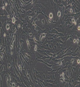 U251人膠質(zhì)瘤細(xì)胞主圖