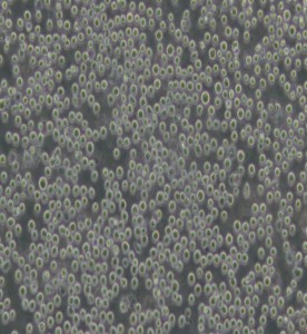 U-937人組織細(xì)胞淋巴瘤細(xì)胞主圖