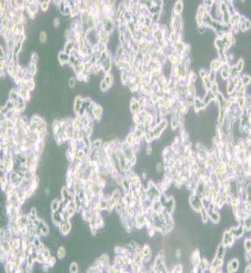 WERI-Rb-1人視網(wǎng)膜神經(jīng)膠質(zhì)瘤細(xì)胞主圖