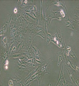 WPMY-1人正常前列腺基質(zhì)永生化細胞主圖