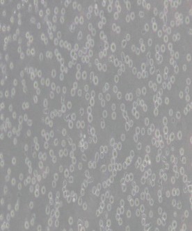 CCRF-CEM [CCRF CEM]人急性淋巴細(xì)胞白血病T淋巴細(xì)胞主圖