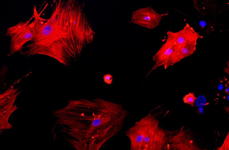 小鼠主動脈平滑肌細(xì)胞主圖
