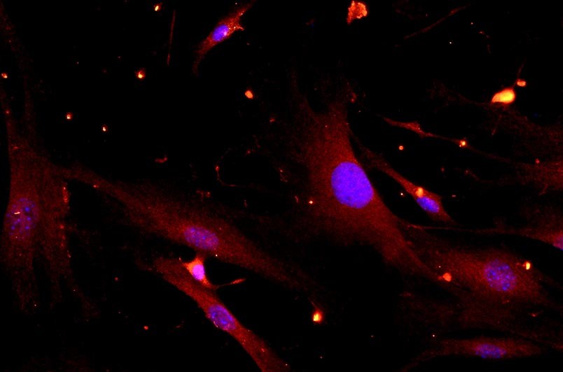 小鼠滑膜細(xì)胞主圖