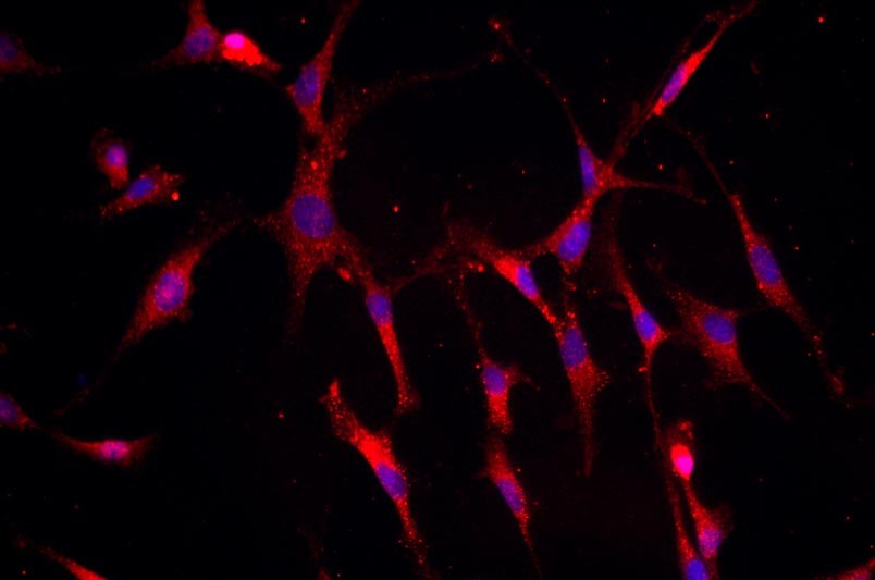 小鼠關節(jié)軟骨細胞主圖