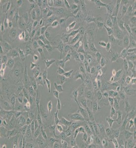 ARPE-19人視網(wǎng)膜上皮細(xì)胞主圖