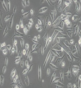 Calu-6人退行性癌細(xì)胞主圖