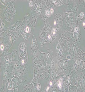 Caov-3人乳突狀卵巢腺癌細(xì)胞主圖
