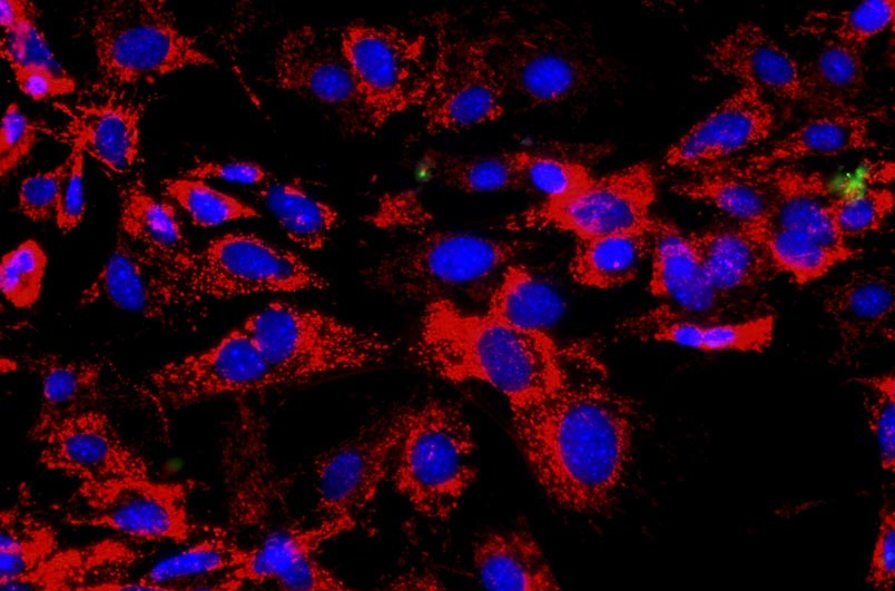小鼠胸腺上皮細胞主圖