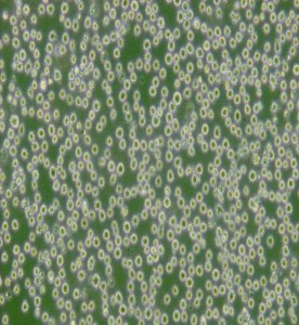 DB-彌漫大B細(xì)胞淋巴瘤細(xì)胞主圖