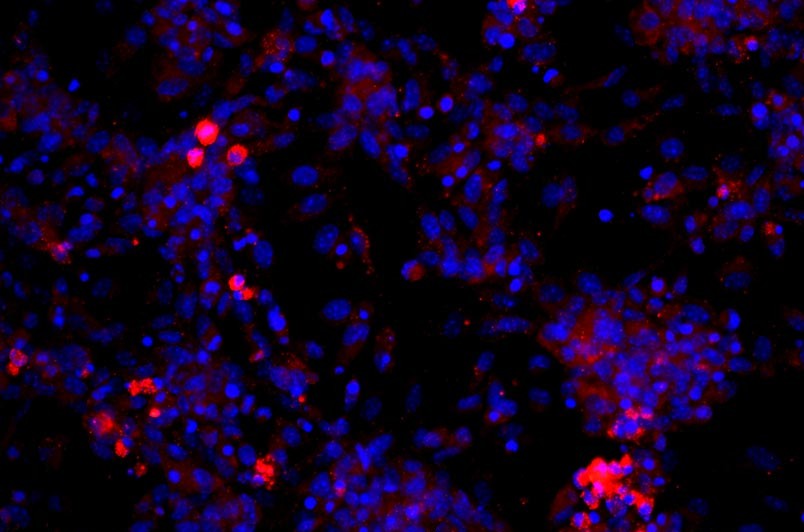 小鼠真皮微血管內(nèi)皮細(xì)胞主圖