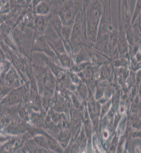 HTh-7人甲狀腺癌細(xì)胞主圖
