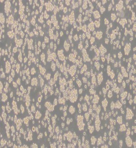 Jurkat, Clone E6-1人T淋巴細胞白血病細胞主圖