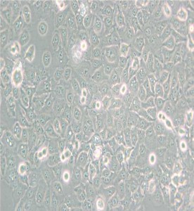 KYSE-150人食管鱗癌細(xì)胞主圖