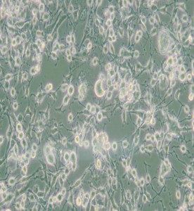 MDA-MB-436人乳腺癌細(xì)胞(DMEM)主圖