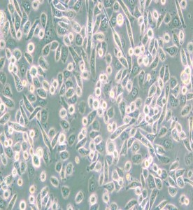 PC-9人肺癌細(xì)胞主圖