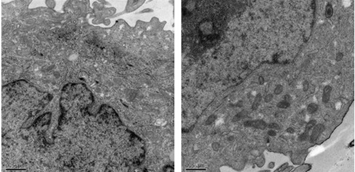 透射電鏡下細胞結(jié)構(gòu)
